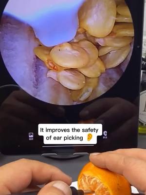 A post by @hanfu59 on TikTok caption: #CapCut Visual ear spoon #passyourwavytalk #needtoknow #usful #goodthing #safety #clean 