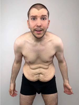 A post by @realnikocadoavocado on TikTok caption: I’m seeing @J. Timothy Katzen, M.D.  to get a 360 body lift and arm lift. My results will be on his page 🔥🔥🔥