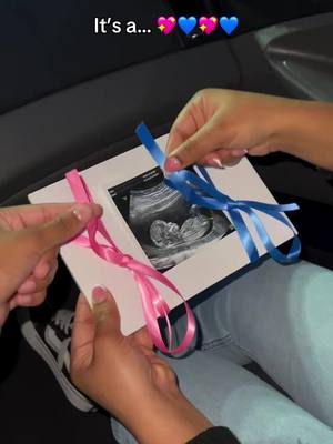 A post by @petitelightts on TikTok caption: and its…. 80$ off 💗🔗 #pregnant #pregnantlife #baby #babytok #babyreveal #genderreveal #fyp #trending #gender #ultrasound 