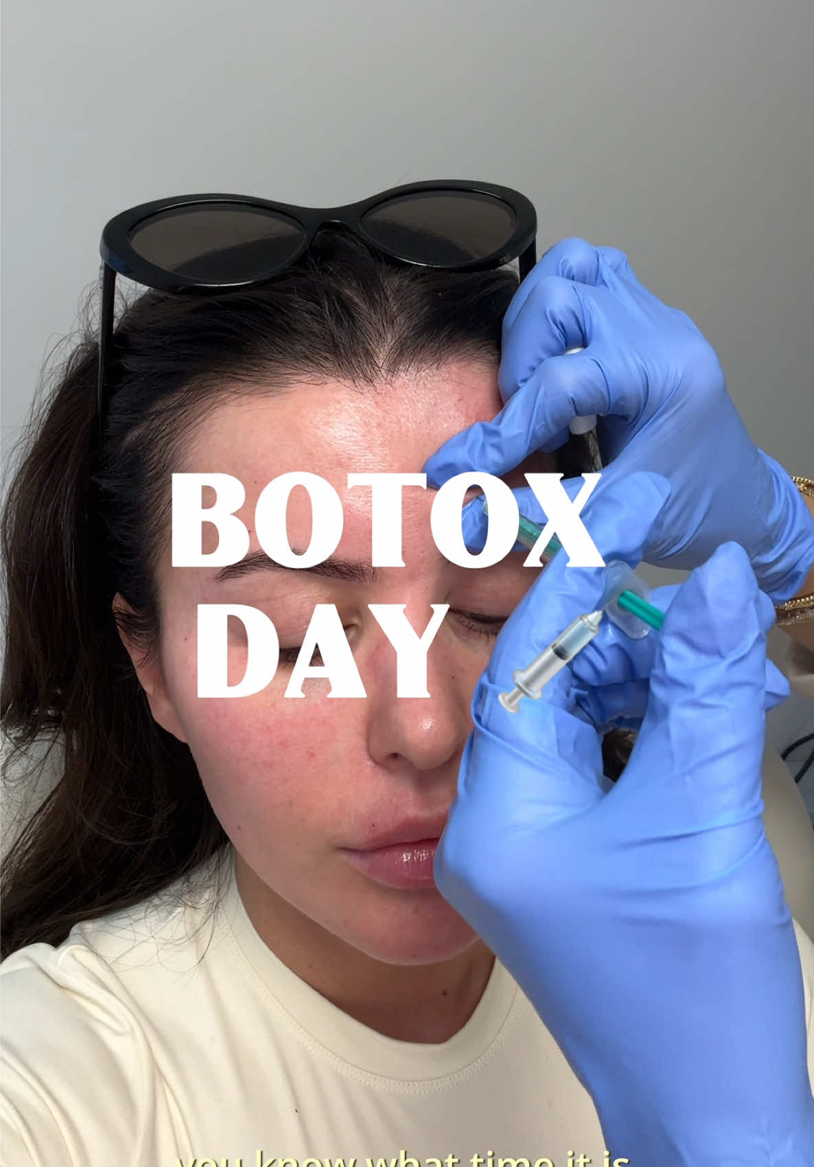 A post by @amrezy on TikTok caption: Botox days @Laura Dyer, PA-C >>>