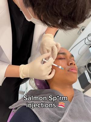 A post by @_angelomarasigan on TikTok caption: Would YOU try this treatment? 💉👀 @Jeunex Clinic #salmondna #salmondnafacial #southkoreafacial #southkoreatreatment #koreanskincare #beautytreatments #koreanbeautytreatments