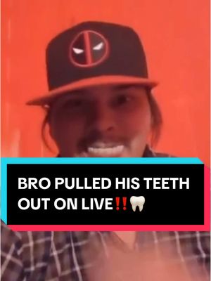 A post by @josselynmorris on TikTok caption: DAWG WTF 😭😭😭😭😭  #teeth #dentist #dentures #josselynmorris #josselynmorrislives #wild #crazy #LIVEHighlights #LIVEIncentiveProgram #PaidPartnership 