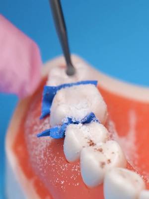 A post by @5.minute.crafts on TikTok caption: Reminder to take care of your teeth! 🦷🤓  #howto #doctor #dentist #craft #oralhygiene #fyp #5mc #restoration 