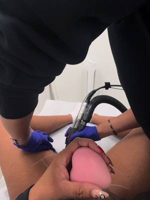 A post by @tiffoniii on TikTok caption: Pain 1/10 def recommend 🥰😍 I’m now a laser girly pop #fypシ #atlantalaser 