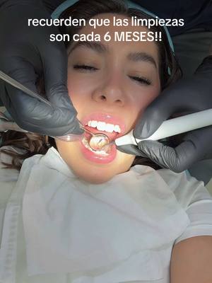 A post by @lilyxgarcia on TikTok caption: limpieza dental con el mejor 🦷❤️