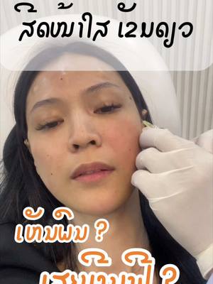 A post by @qtcomx on TikTok caption: ໃຜຢາກຈະສີດໜ້າໃສ ເບີ່ງຄິບນີ້