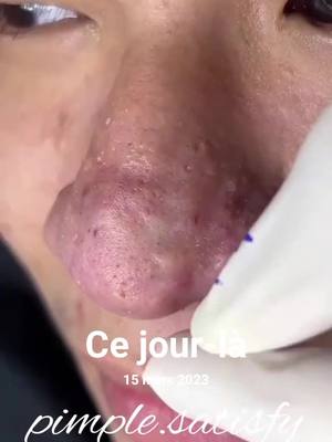 A post by @pimple.satisfy on TikTok caption: #cejour-là #ConSantanderConecto#explore #fyp #foryou  @Caftan Reverie 