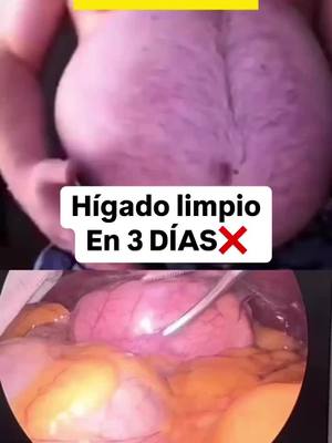 A post by @alexcifuentesfit on TikTok caption: 🧽 RECETA PARA LIMPIAR EL HÍGADO Y DESINTOXICAR 🧽 Si sientes hinchazón, fatiga o problemas digestivos, ¡es momento de limpiar tu hígado! Prueba este jugo natural: ✅ 1 manzana verde ✅ 1 zanahoria picada ✅ 1 rama de apio ✅ 1 vaso de agua Licúa todo, cuela y toma en ayunas de 3 a 7 días según tu caso. ¡Tu cuerpo lo agradecerá! 💬 Comenta tu país y te enviaré mi recetario. Además, únete a mi Reto 30 días para desintoxicar, limpiar tu hígado y bajar de peso. #DesintoxicaTuCuerpo #LimpiezaHepática #Reto30Días