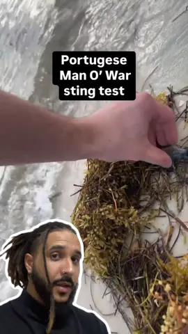 A post by @mesquitareacts on TikTok caption: Ele testou a dor da queimadura de uma CARAVELA PORTUGUESA! 🪼😱 . . . #animaisnotiktok #bichos #curiosidades #curiosidadeanimais #agoravocesabe #aprendanotiktok