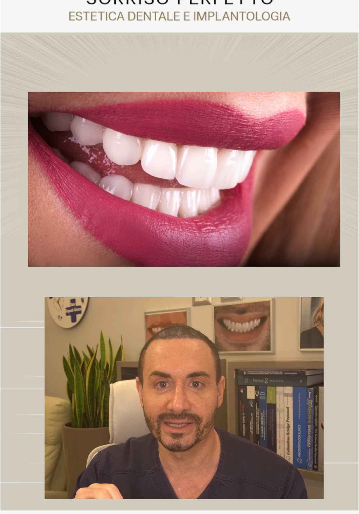 A post by @cannizzostudio on TikTok caption: Dr. CANNIZZO Gianpaolo solo a Milano in via Donatello 11 #faccette #faccettedentali #bondingdentale #cannizzostudio #dentistamilano #sorriso #dentibianchi #fyyy #fyyp #neiperte #virale 