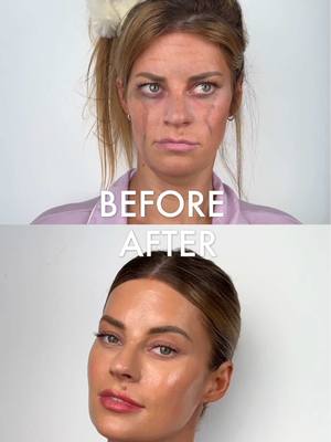 A post by @hannahstocking on TikTok caption: The official breakup cure with the OG PDRN skincare @REJURAN US ❤️ #rejurancosmetics #rejurancosmetics