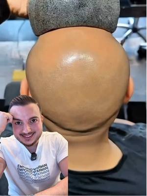 A post by @ismailguseynlirus on TikTok caption: Это супер дешёвый и эффективный рецепт против перхоти на волосах ✅ #исмаилгусейнли 