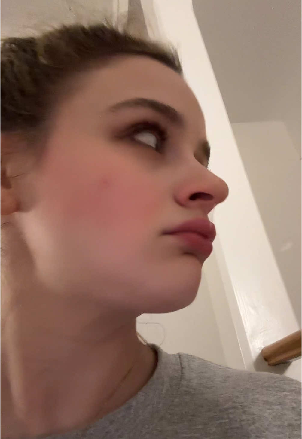 A post by @joeyking on TikTok caption: Just kidding we are not  Apoquel girlies in this house anymore  