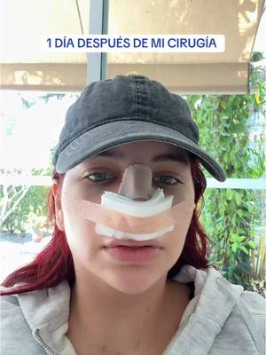 A post by @marianyyaaa on TikTok caption: Apenas van 14 días y ya la amoooo 🙂‍↕️✋🏻✨, ¿que opinan?, mi doc: @drjaviersoto  #fyp #rinoplastia 