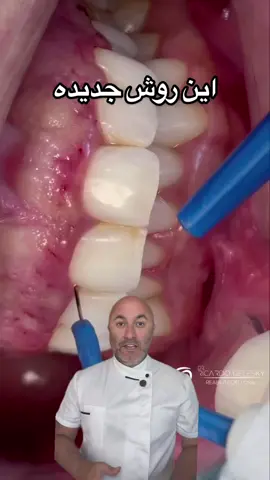 A post by @ on TikTok caption: Gummy smile #gummysmile #dentistdubai 