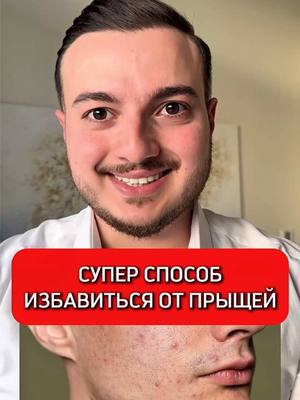 A post by @ismailguseynlirus on TikTok caption: Супер способ против прыщей ✅ #прыщи #прыщиналице #исмаилгусейнли 