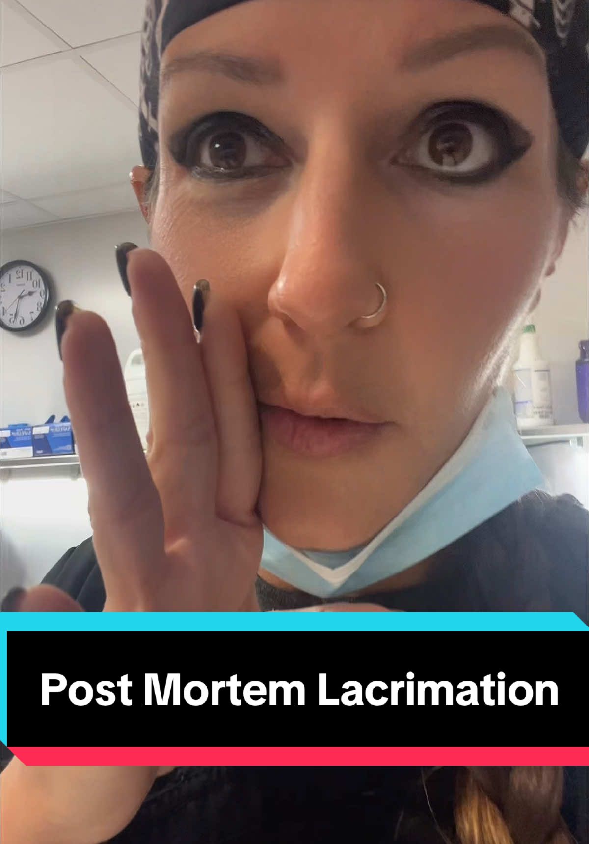 A post by @mortuivivosdocent127 on TikTok caption: Replying to @glowwby_mo “crying” after death #death #learning #death #crying #paramedic #fyp #foryoupage #autopsytech #LearnOnTikTok 