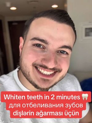 A post by @ismailguseynlirus on TikTok caption: Whiten your teeth in 2 minutes 🪥🦷