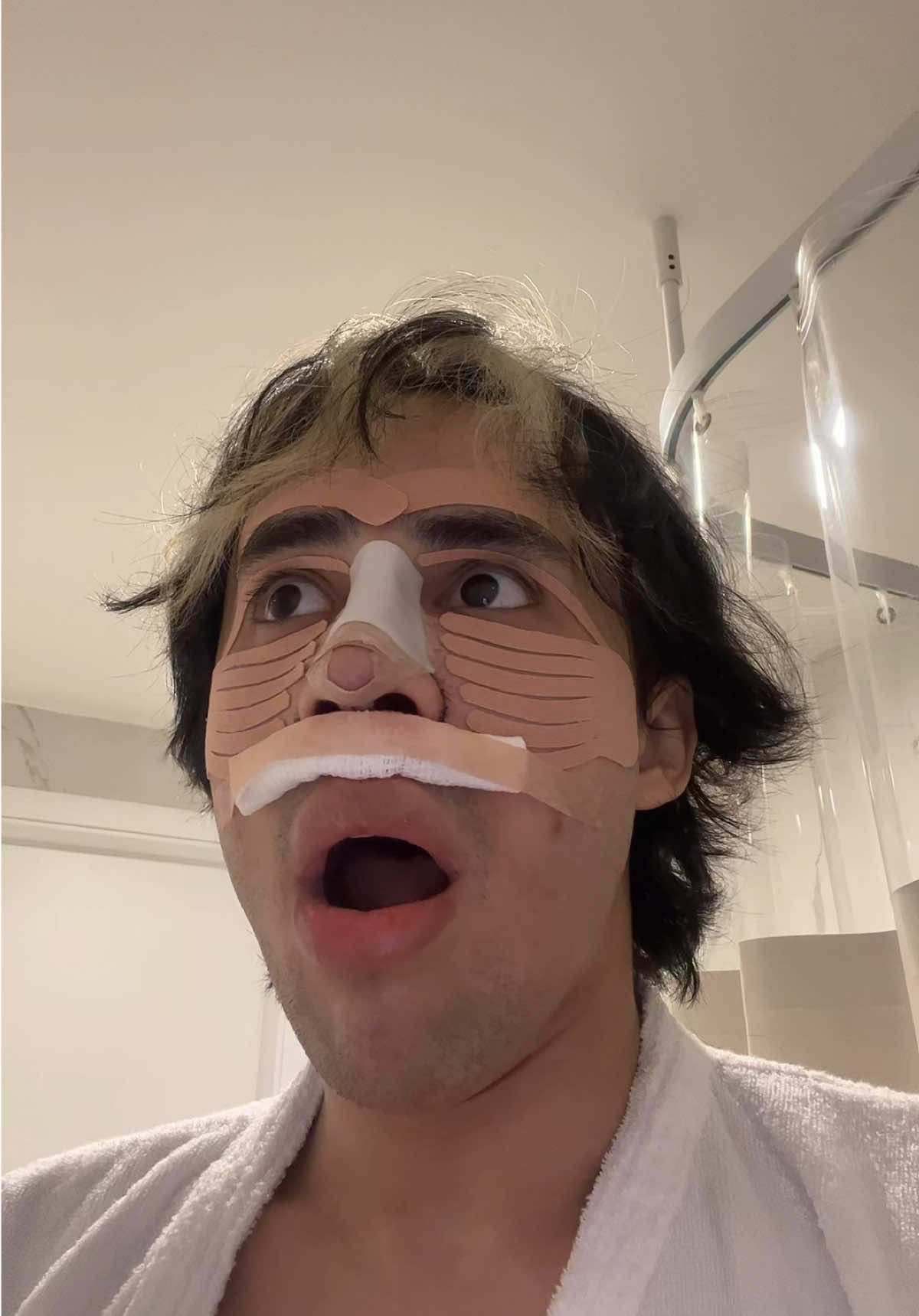 A post by @rafaelsantos on TikTok caption: vai sair vídeo completo lá no c4nal.. @Frederico Keim #rinoplastia 