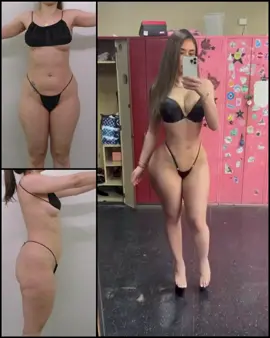 A post by @realdrjungmoney on TikTok caption: Eat your heart out! Waist is snatched and 🍑 is phat! GYM or JM #fyp #bbl #lipo 