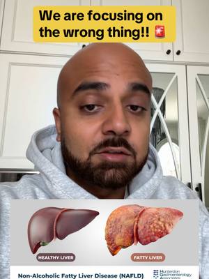 A post by @ravmalik on TikTok caption: Protect your liver  #health #fyp #nafld 