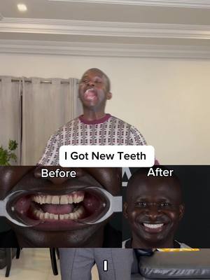 A post by @maximbadyofficial on TikTok caption: New teeth, who this. I got 5 star treatment from Prime Dental Turkey while getting my new teeth. I would recommend them 10 out of 10 