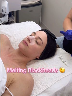 A post by @lilireinhart on TikTok caption: if you enjoy a satisfying squeeze—like me, this is the best & safest option for you 🙏🏻😏 these new blackhead melting nose strips by @Personal Day are so good and gentle on your skin 💚 