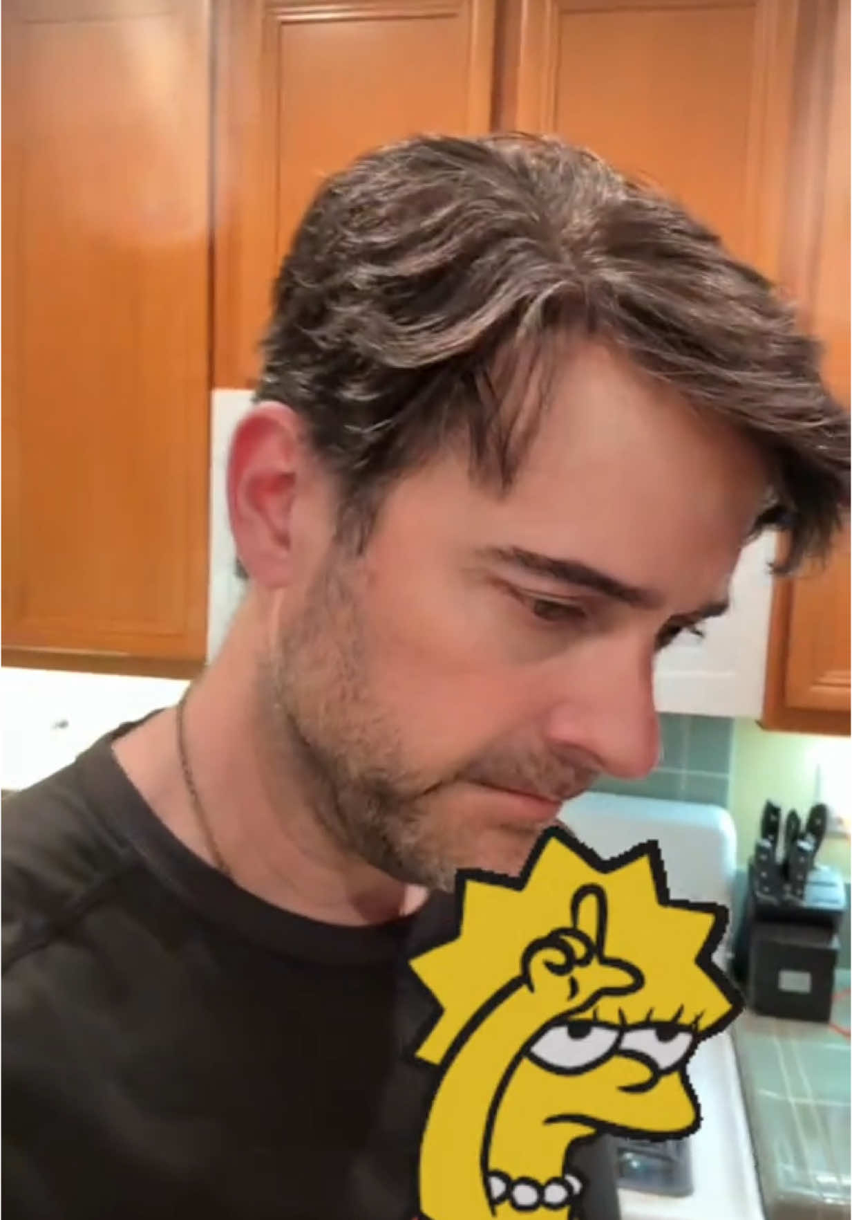 A post by @andrewsbowen on TikTok caption: The joys of being a lifetime klutz 😑.  #Add #ADHD #clumsylife #klutzcertified #klutzy #walkingdisaster 