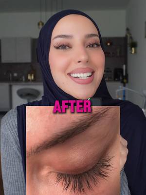 A post by @baraa.bolat on TikTok caption: Q&A all you need to know about our  @elashgance lashserum 💗🤝 #lashserum #growthlash #elashgance #longlashes 