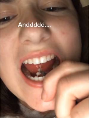 A post by @thebentist on TikTok caption: Why This Retainer Could FAIL YOU! 😭🦷 #teeth #retainer #braces 
