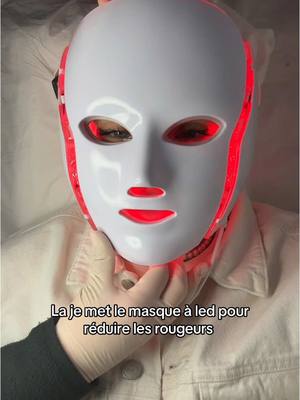 A post by @no_faceixyy on TikTok caption: J’ai testé le lifting coréen chez Dozz ! Pour atténuer les rides et les cernes ! Pour prendre vos rendez vous c’est dans la bio de @DOZZ OFFICIEL et pour vous formez au lifting coréen envoyez un message sur whatapp au 07.56.99.56.69🩷       #CapCut #devinelapersonne #fypシ゚ 