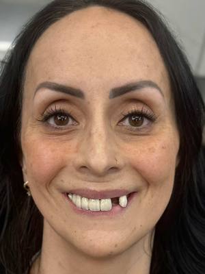 A post by @drkennysmilesofficial on TikTok caption: After losing her dad in a tragic fire, her grief took over everything. Including her smile. But today, she took one step back towards herself. This is the start of something new  #tragic #fire #sad #inspiring #makeover #transformation #heartwarming #fyp 
