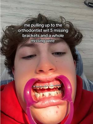 A post by @thebentist on TikTok caption: This Simple Mistake Can Cost You YEARS In Braces! 😭🦷 #teeth #braces #dentist 