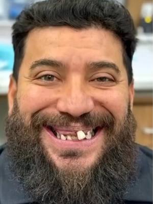 A post by @drkennysmilesofficial on TikTok caption: This isn’t shit…this is “holy” shit 😏 in 24 hours… #makeover #bestever #dentist #implants #mancrush #dental #dentistry 