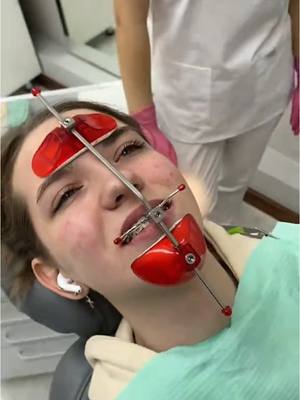 A post by @thebentist on TikTok caption: The WORST Orthodontic Appliance EVER! 😭🦷 #teeth #braces #dentist 