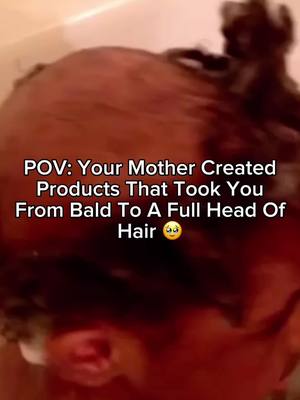 A post by @baskandlatherco on TikTok caption: Insane growth from this natural and non-toxic product 😱🚨‼️ #tiktokshopfinds #baskandlatherco #fyp #4chair #hairgrowth #hairloss  Results may vary and consistency is key *