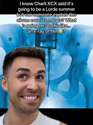 A post by @joebxggs on TikTok caption: X-rays out for Lorde xxx