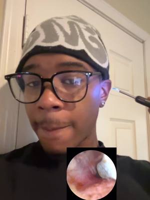 A post by @iiiamlee__ on TikTok caption: #fyp #virall #satisfying #earwaxremoval 