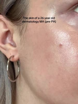 A post by @yourblondegaby on TikTok caption: Skin is skin! Texture, blemishes, and all! 🥹 #fyp #skin #dermatology #physicianassistant #medicalassistant #prepa 