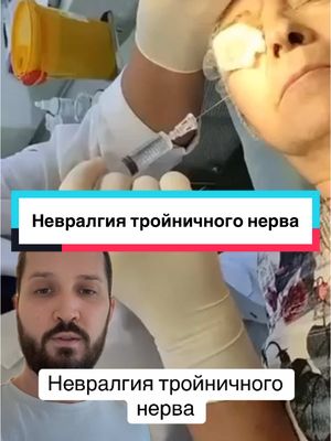 A post by @dr_radion on TikTok caption: 🥇 inst:doctor_radion  #невралгиятройничногонерва  
