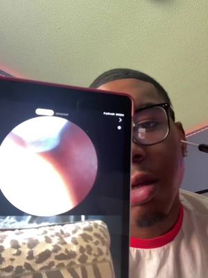 A post by @iiiamlee__ on TikTok caption: I will never go back cotton swabbing 🫸🏽#fyp #viral #earwaxremoval #tiktokmademebuyit 