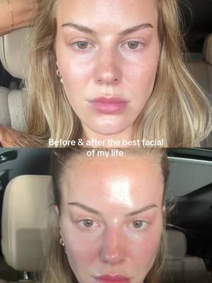 A post by @anggwells on TikTok caption: @FORMULA FIG bespoke facial leaves you so snatched and glowy, just get it
