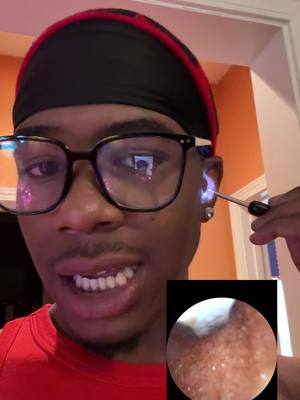 A post by @iiiamlee__ on TikTok caption: Clean yo ear#fyp #viral #tiktokmademebuyit #earwaxremoval 