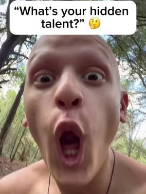 A post by @xtheromanempire on TikTok caption: My most USELESS TALENT! #comedy #funny #talent #alopecia