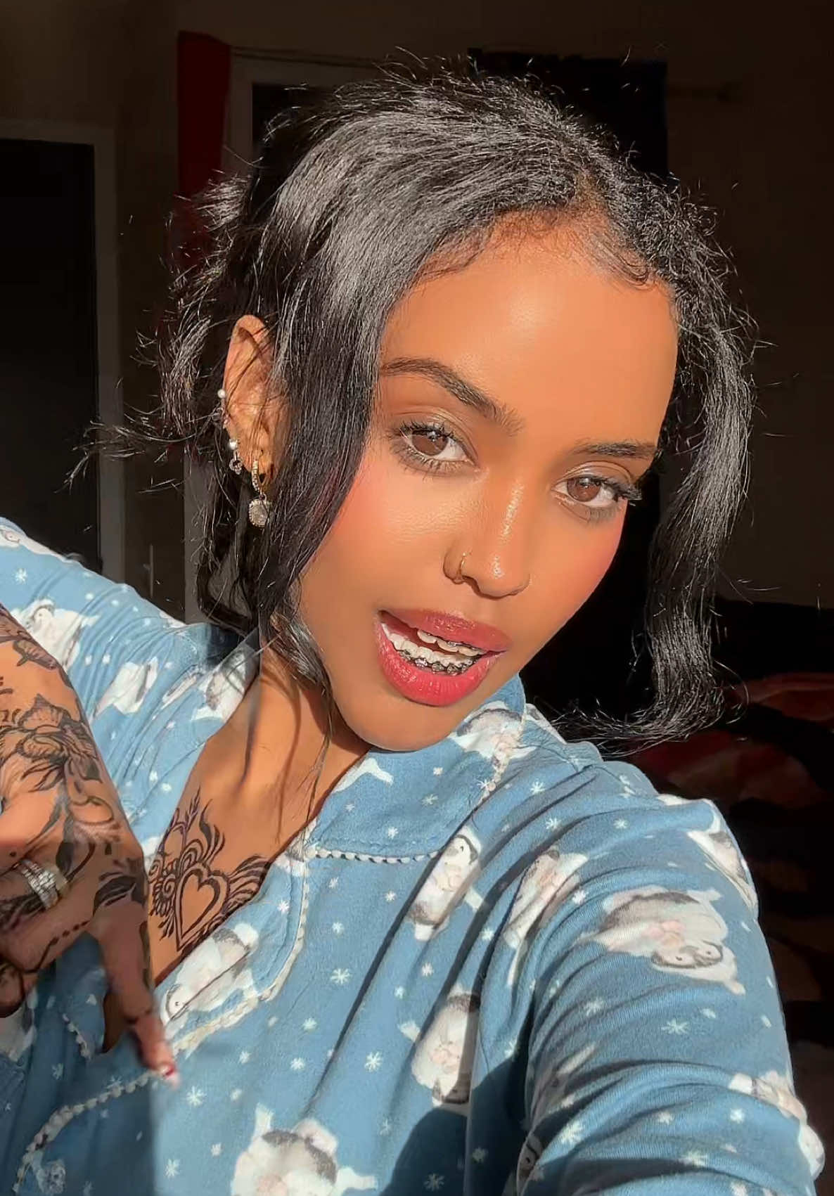 A post by @silly_m3_ on TikTok caption: The sun just loveeees my skin 