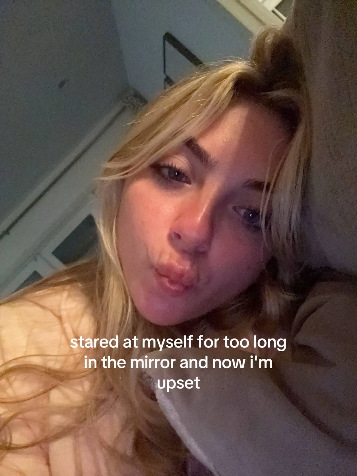 A post by @ on TikTok caption: #acne 