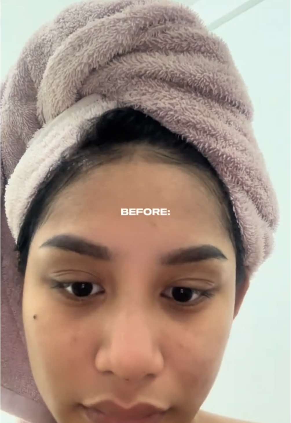 A post by @sandengdump on TikTok caption: goodbye acne & pores talaga pag G2G