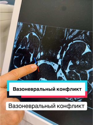A post by @dr_radion on TikTok caption: Вазоневральный конфликт