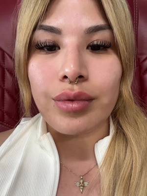 A post by @marileperez on TikTok caption: I got it!!!!! 🥹 #nosejob #rinoplastia 