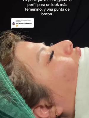 A post by @marileperez on TikTok caption: Replying to @Michoacana Leon #rinoplastia 